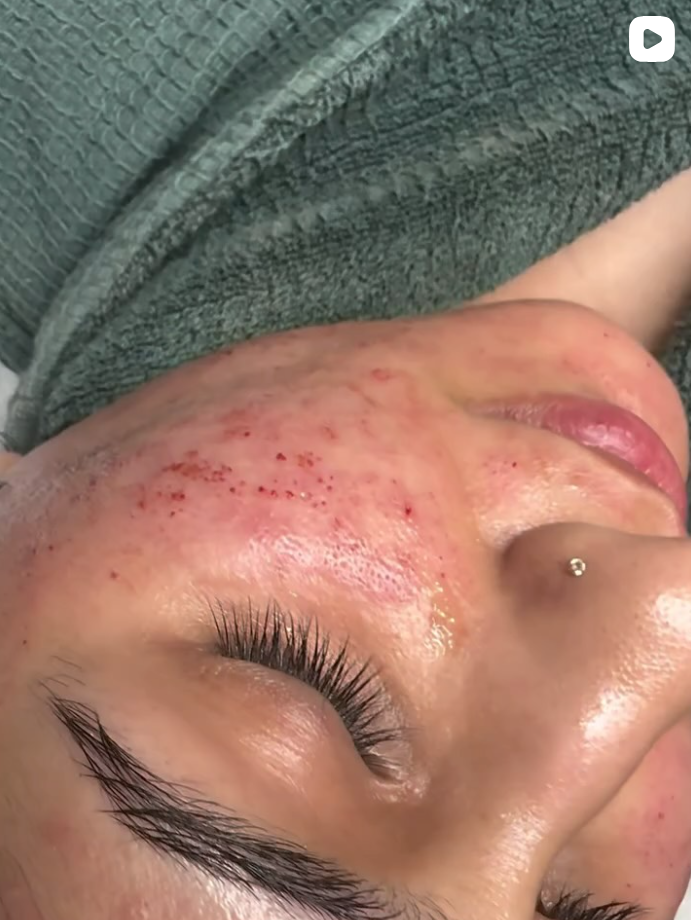 Instagram preview for Hebe Aesthetics post 5